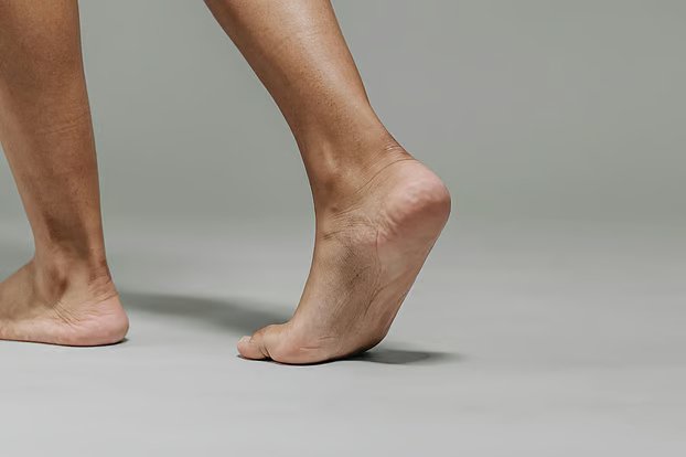 ক্যালকেনিয়াম স্পার বা গোড়ালির হাড় বাড়া রোগ